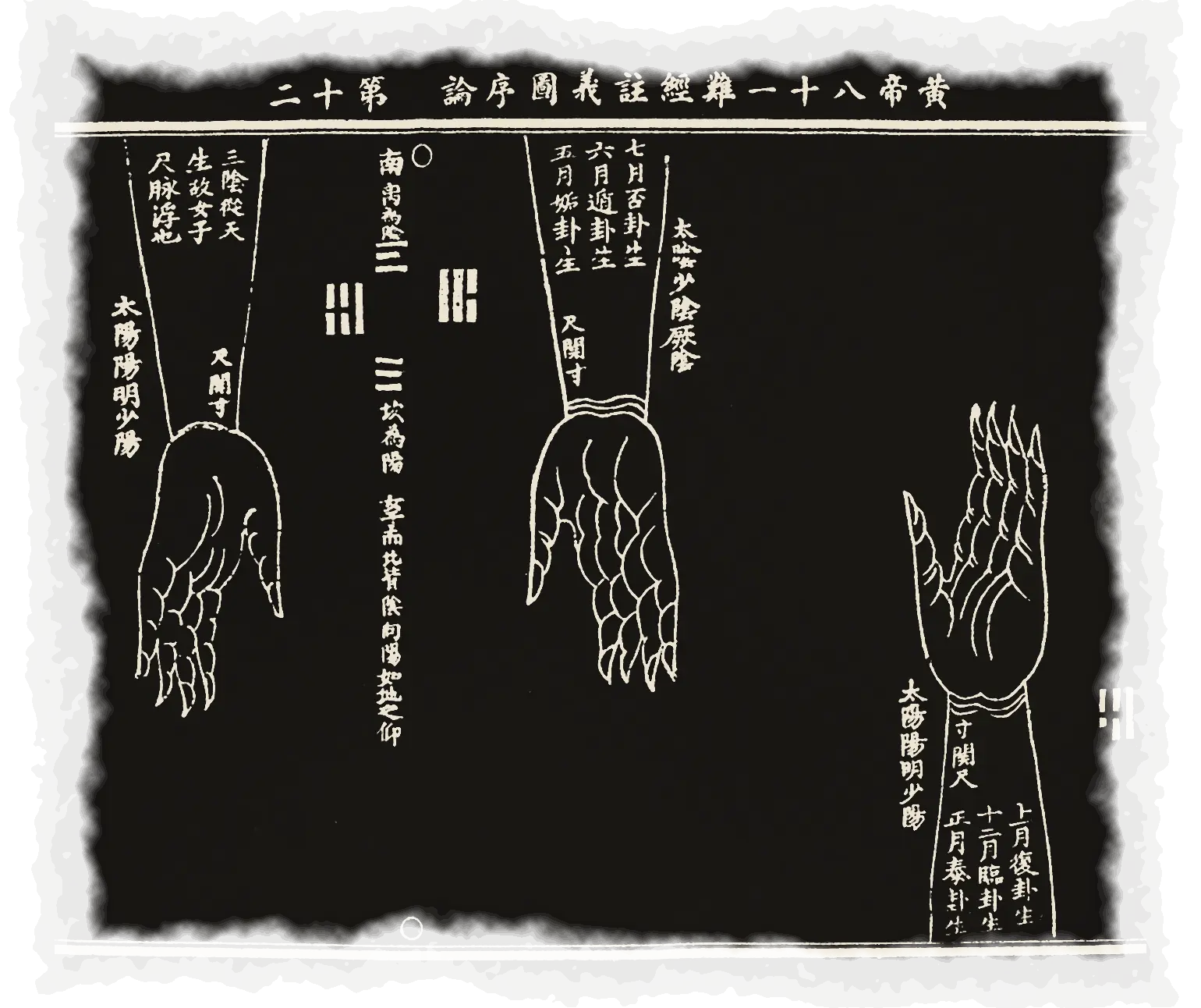 寸关尺脉位图：三只手，手腕旁竖写着寸、关、尺与月份、卦名，空处画着卦